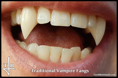 Permanent fangs. Things To Know About Permanent fangs. 